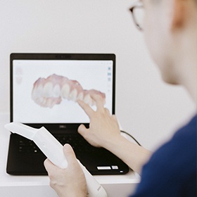 Intra Oral Scanner 2